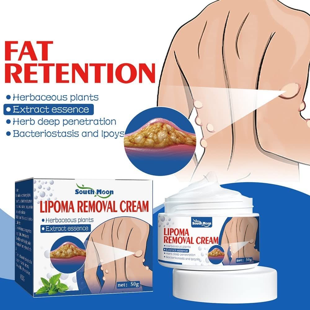 South Moon Lipoma Removal And Body Smoothing Cream 50g Herbal Natural Lump And Skin Knot Relief Ointment