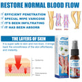 30Ml Varicose Veins Treatment Spray Varicose Vein Treatment Cream Repair Varicocele Removal Pain Relief Kidney Inflammation Legs Vein Health Care Spray 856560