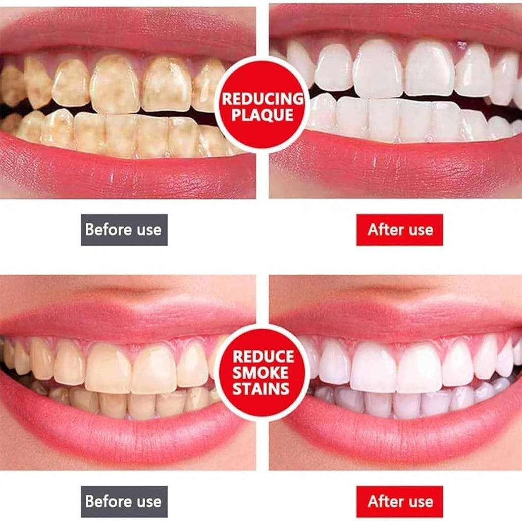 Yayashi Sp 4 Ultra Whitening Toothpaste Strong Stain Removal Fresh Breath Daily Oral Care - 120g