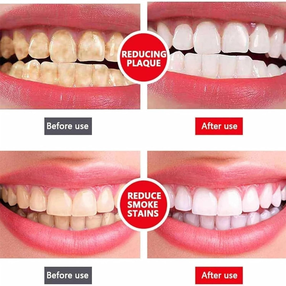 Yayashi Sp 4 Ultra Whitening Toothpaste Strong Stain Removal Fresh Breath Daily Oral Care - 120g