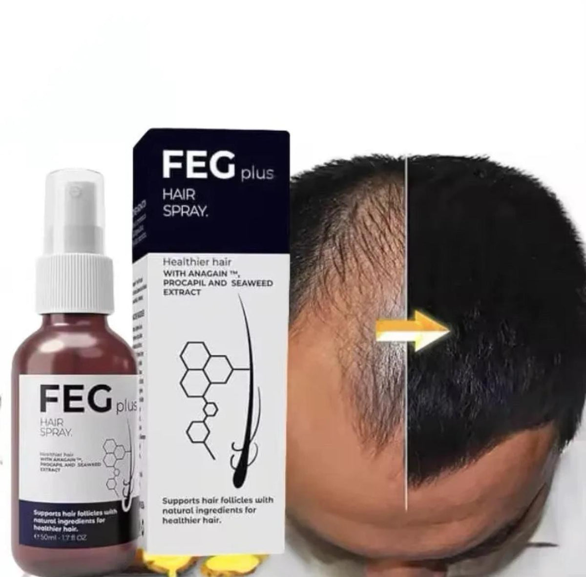 FEG PLUS Hair & Beard Regrowth Spray – Anti Hair Loss Formula with Minoxidil, Redensyl & Natural Extracts (50ml)