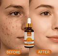 Relax Vitamin C Daily Serum – Brightening & Anti-Aging Face Serum - 30ml