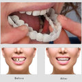 Snap On Smile Veneers Teeth For Men And Women Moldable False Artificial Braces Teeth
