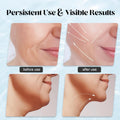 Massager For Face Lifting Facial Massagers Ems Neck Eye Massage Instrument Vibrator Microcurrents Red Light Therapy Anti Wrinkle Random Color 3306241