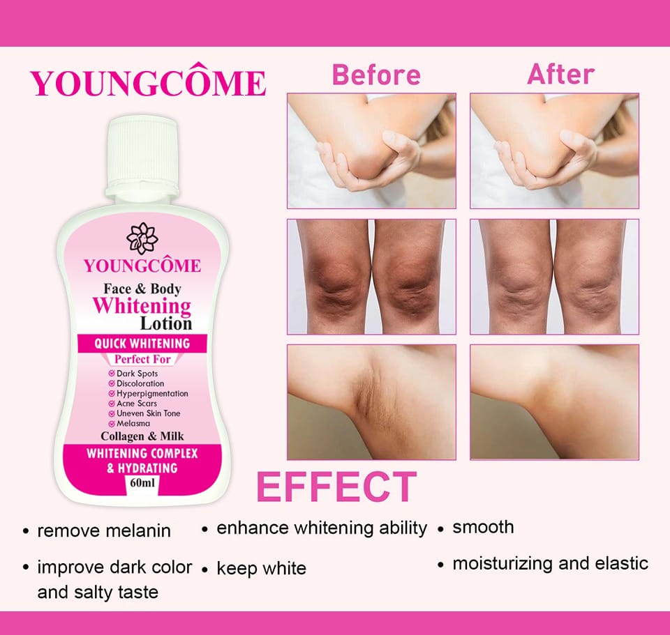 Youngcome 60Ml Face Body Whitening Lotion Underarm Brightening Private Underarm Body Cream Legs Whitening Parts 2