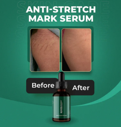 Markaway Stretch Mark Serum Herbal Formula for Scars & Skin Elasticity 30ml Nourishing, Repairing & Firming Skin Treatment