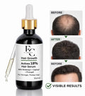 Herbal Hair Growth Serum 30ml | Rosemary & Onion Water-Based Formula