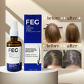 Feg Plus Hair Beard Regrowth Spray 50Ml Anti Hair Loss Formula With Minoxidil Redensyl Natural Extracts