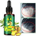 7 Day Ginger Germinal Oil Hair Nutrient Solution Hair Growth Essence Liquid Fast Natural Hair Loss Treatment Hair Care 30Ml