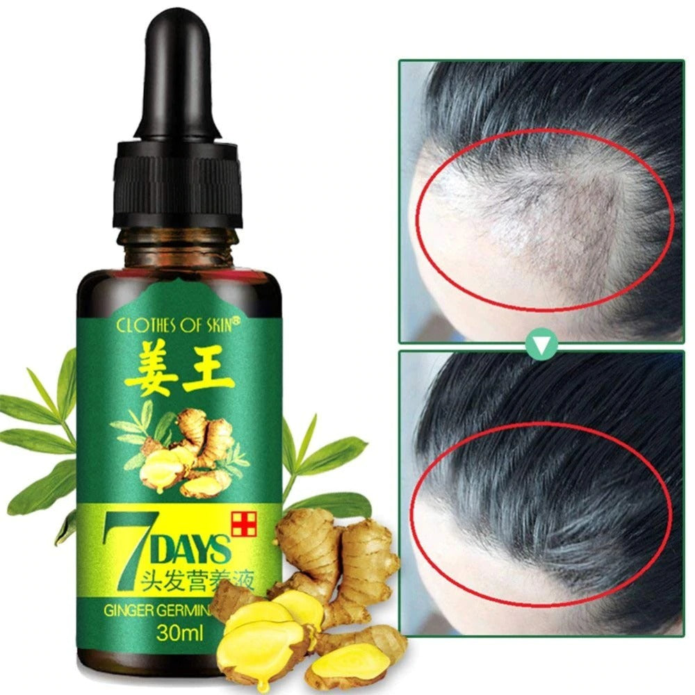 7 Day Ginger Germinal Oil Hair Nutrient Solution Hair Growth Essence Liquid Fast Natural Hair Loss Treatment Hair Care 30Ml