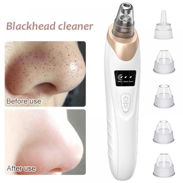 Electric Suction Blackhead Instrument Home Beauty Instrument Blackhead Pore Cleaning 1051384