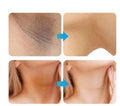 Whitening Cream For Sensitive Areas Underarm And Private Areas 30G