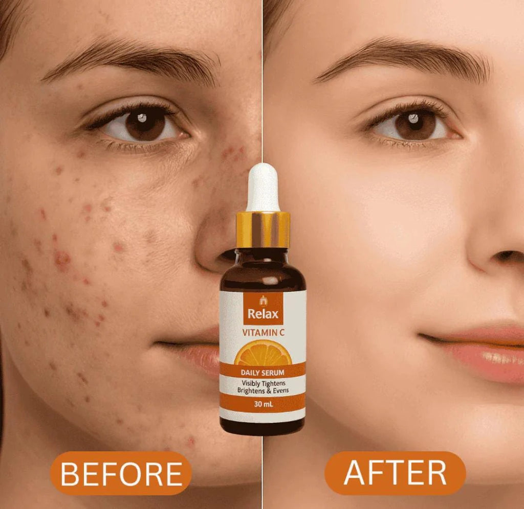 Relax Vitamin C Daily Serum – Glow And Radiance In Every Drop With Brightening Anti Aging Hydration Formula For Healthy Skin – Net Quantity 30ml