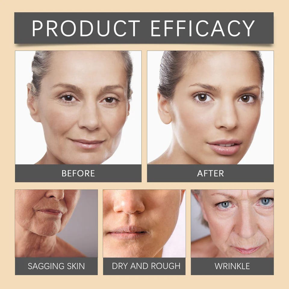 Botox Cream Advanced Skincare Formula For Reducing Wrinkles And Restoring Youthful Glow - 20g