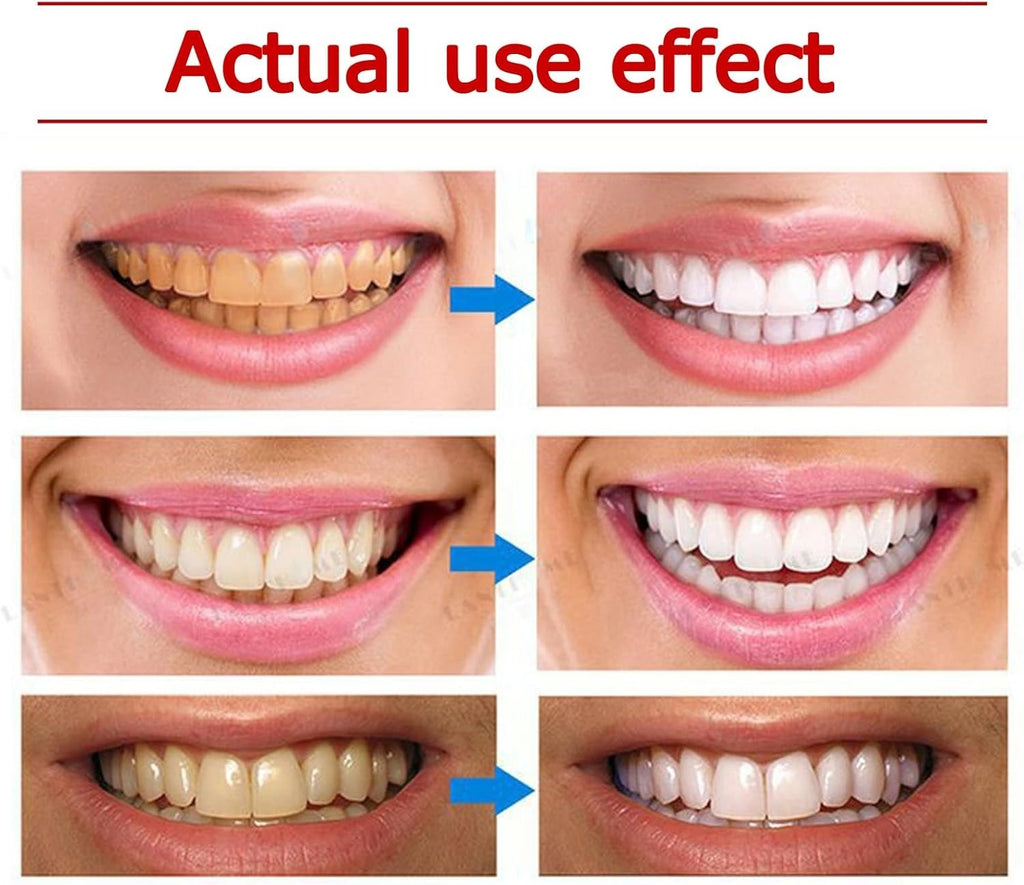 Yayashi SP-4 Ultra Whitening Toothpaste – 150ml Probiotic Stain Remover for Bright, Healthy Teeth