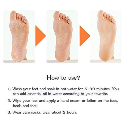 1 Pair Unisex Silicone Gel Socks Moisturizing Sock Breathable Elastic Heel Cracked Protector Socks 920451